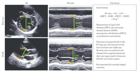 lv walls echo|lv wall thickness echo measurement.